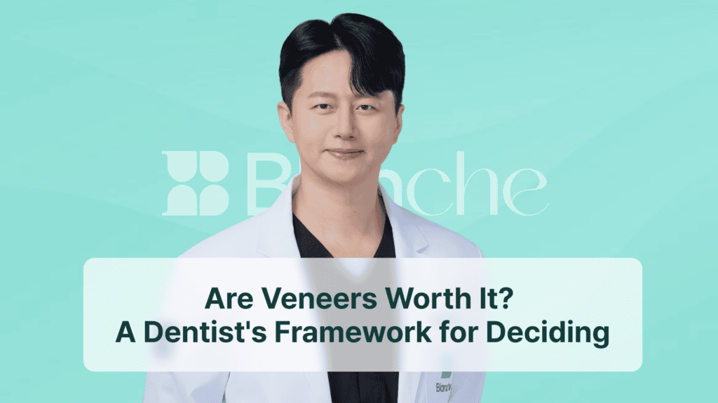 Are Veneers Worth It? A Dentist's Framework for Deciding