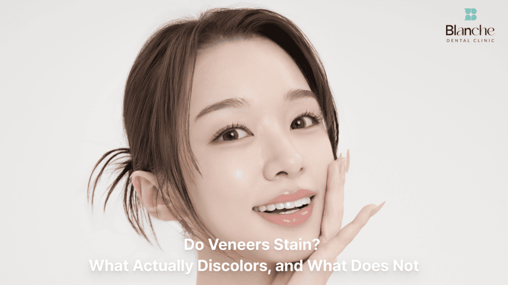 Do Veneers Stain? What Actually Discolors, and What Does Not
