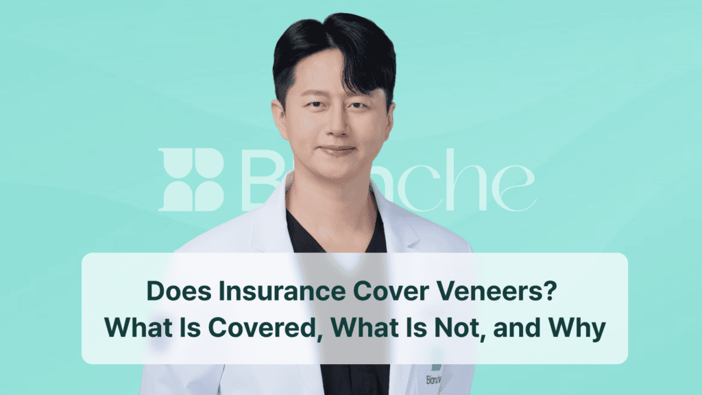 Does Insurance Cover Veneers? What Is Covered, What Is Not, and Why