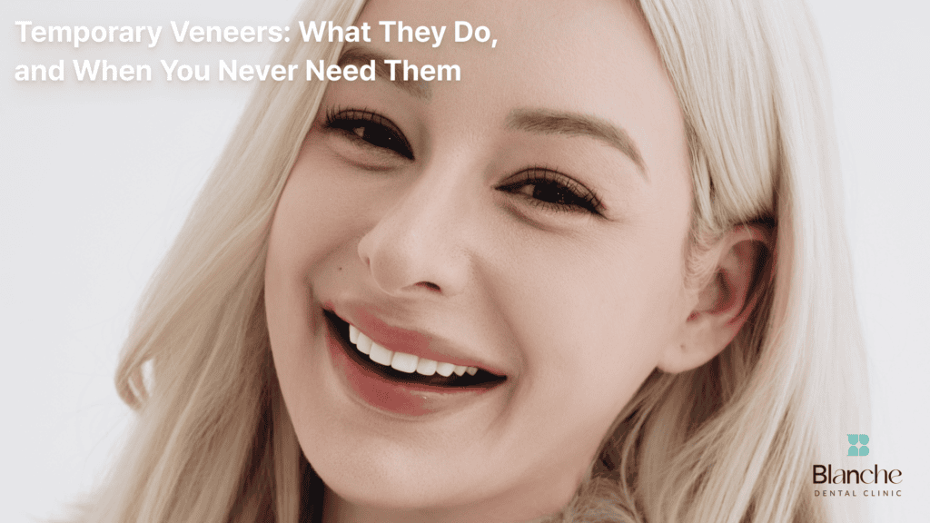 Temporary Veneers: What They Do, and When You Never Need Them