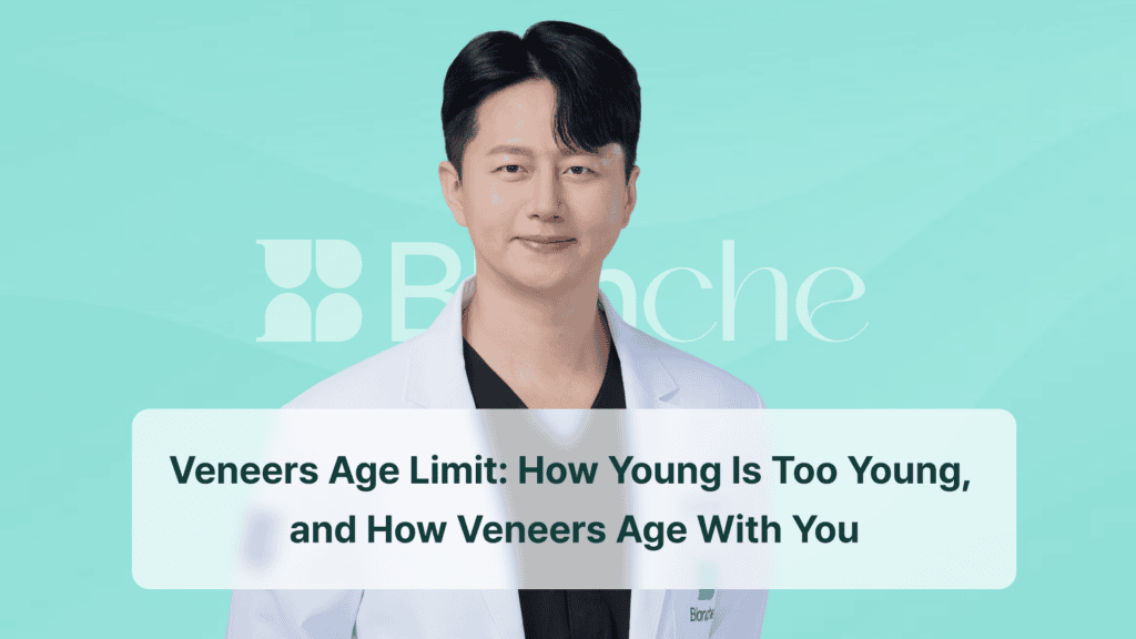 Veneers Age Limit: How Young Is Too Young, and How Veneers Age With You