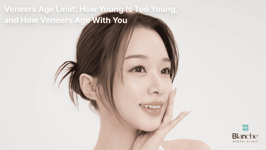 Veneers Age Limit: How Young Is Too Young, and How Veneers Age With You