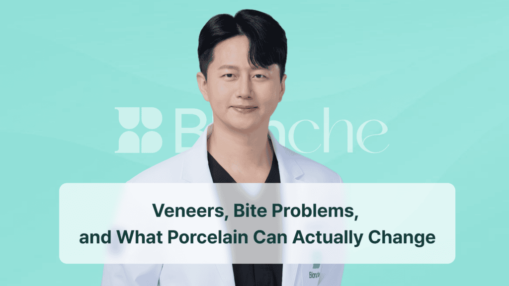 Veneers, Bite Problems, and What Porcelain Can Actually Change