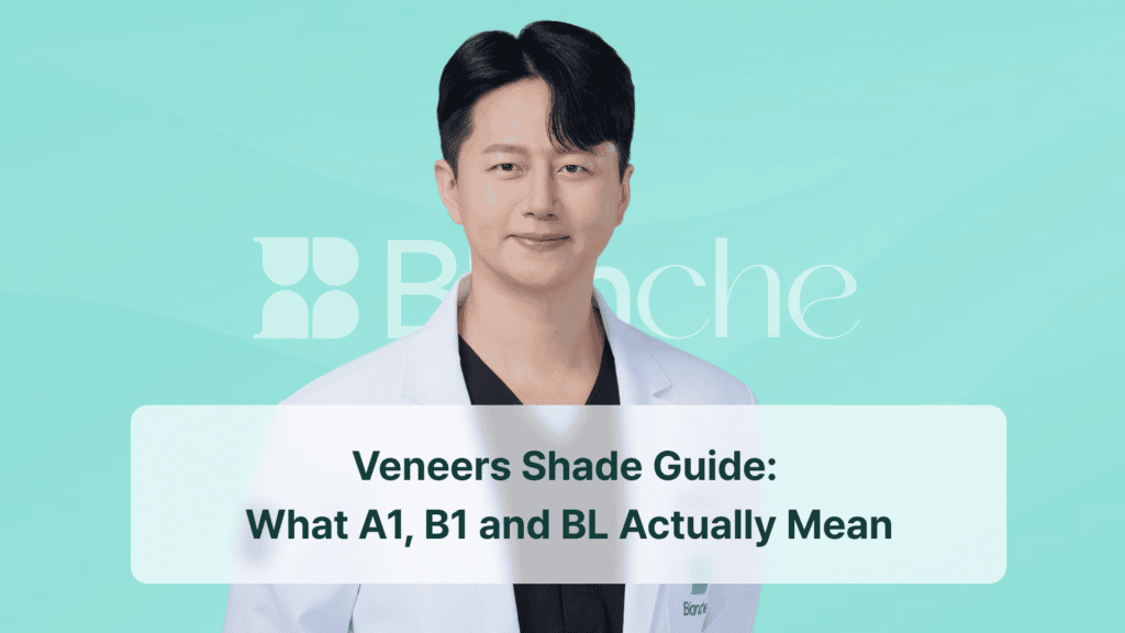 Veneers Shade Guide: What A1, B1 and BL Actually Mean