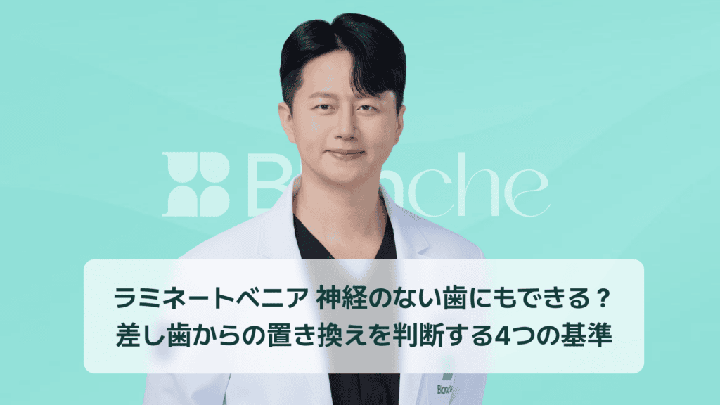 ラミネートベニア 神経のない歯にもできる？ 差し歯からの置き換えを判断する4つの基準