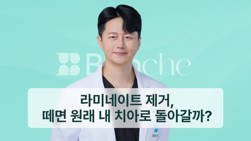 라미네이트 제거, 떼면 원래 내 치아로 돌아갈까?
