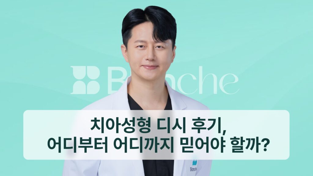 치아성형 디시 후기, 어디부터 어디까지 믿어야 할까?