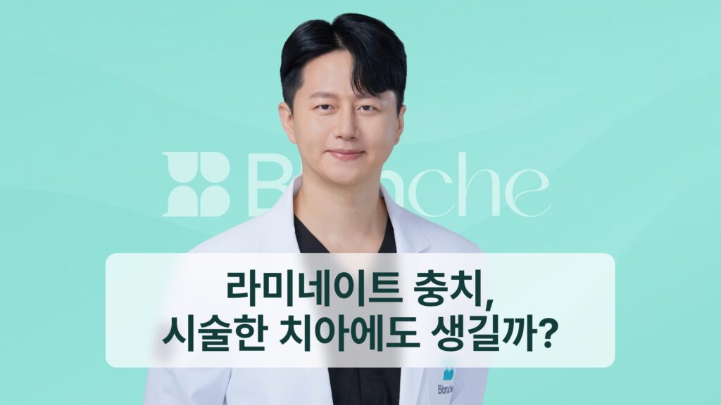 라미네이트 충치, 시술한 치아에도 생길까?