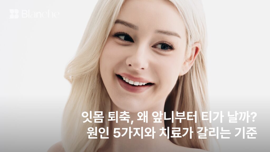 잇몸 퇴축, 왜 앞니부터 티가 날까?