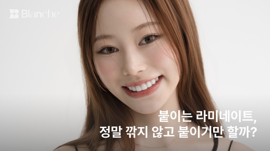 붙이는 라미네이트, 정말 깎지 않고 붙이기만 할까?