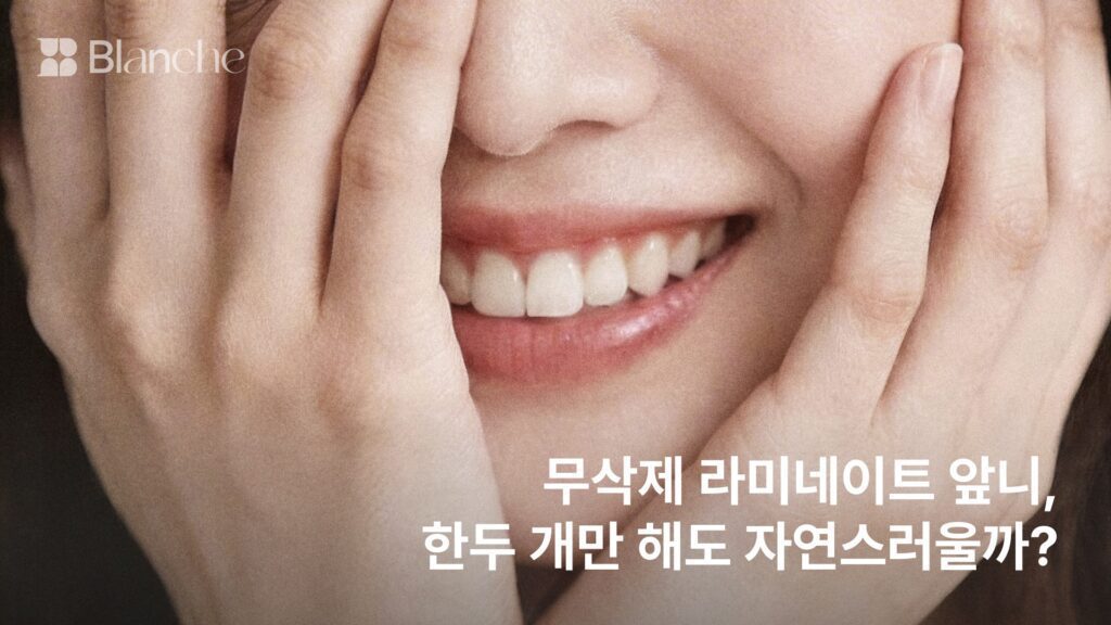 무삭제 라미네이트 앞니, 한두 개만 해도 자연스러울까?