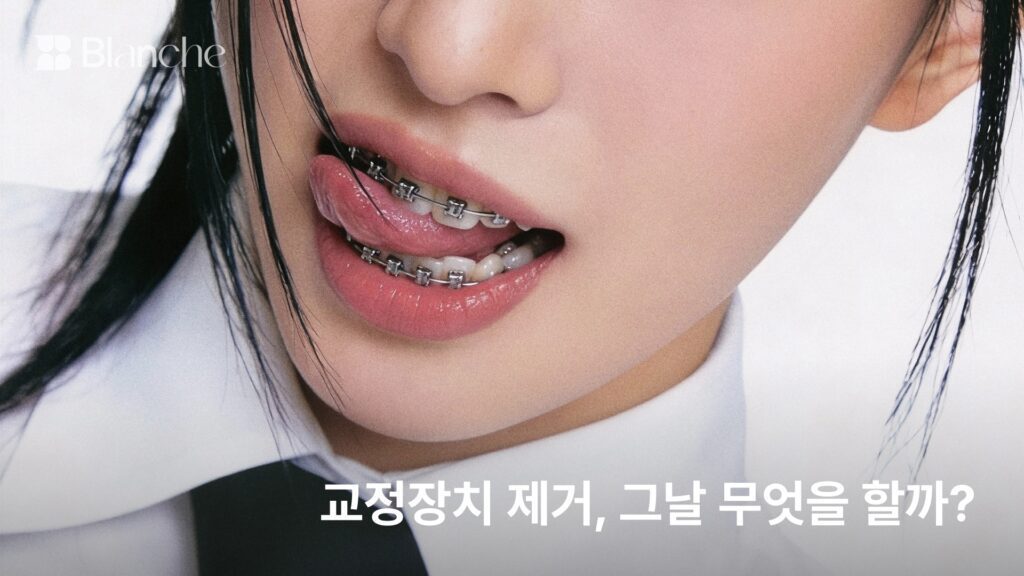 교정 장치 제거, 그날 무엇을 할까?