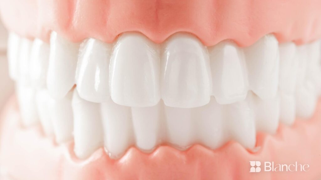 Blanche Dental Clinic, Gangnam Seoul