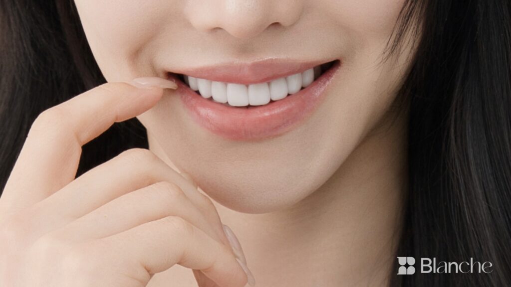 큰 앞니, 라미네이트로 어디까지 조정될까요?