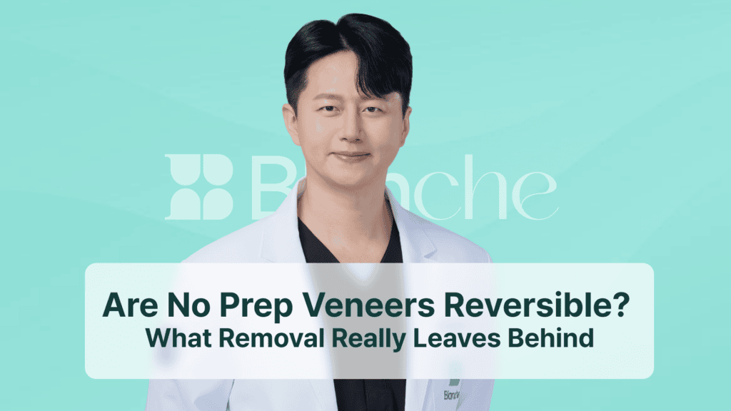 Are No Prep Veneers Reversible? What Removal Really Leaves Behind