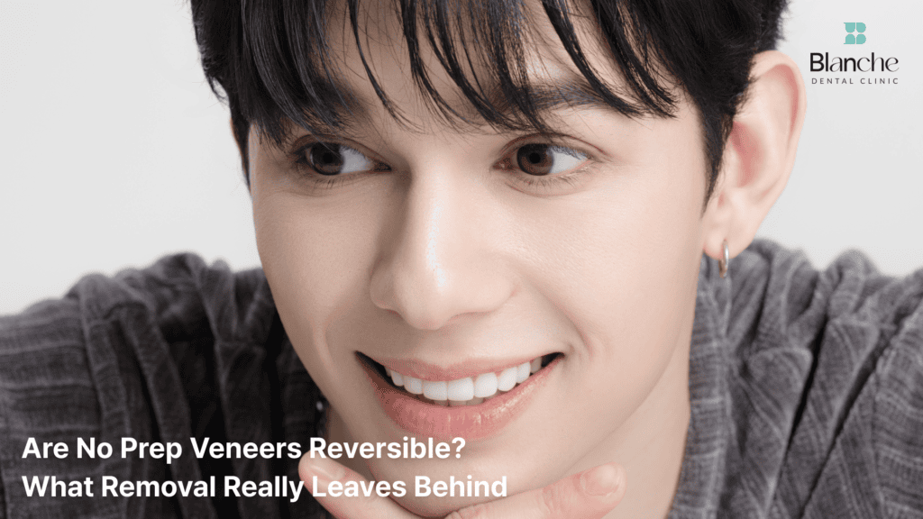 Are No Prep Veneers Reversible? What Removal Really Leaves Behind