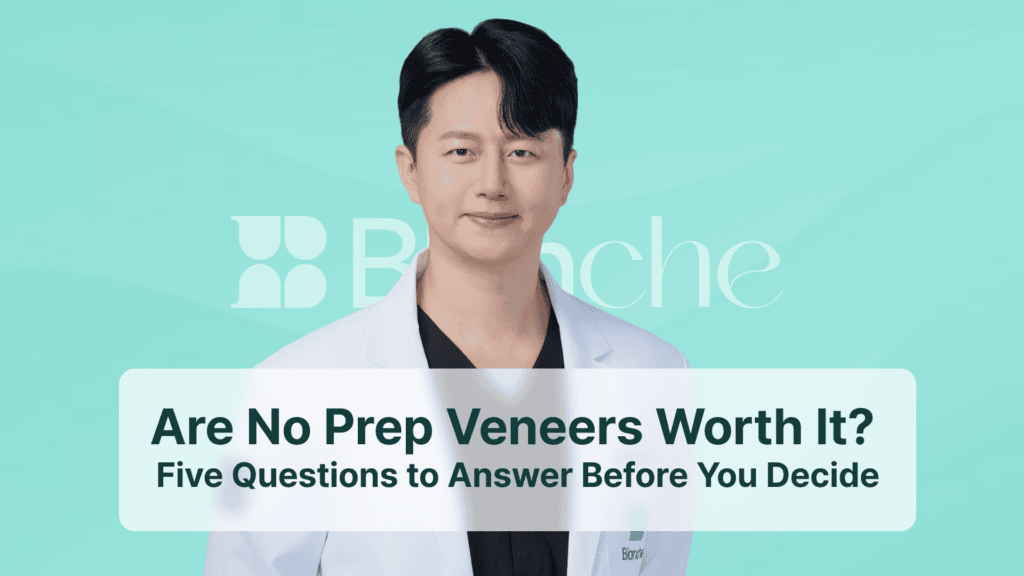 Are No Prep Veneers Worth It? Five Questions to Answer Before You Decide