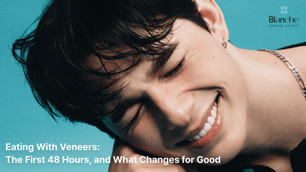 Eating With Veneers: The First 48 Hours, and What Changes for Good
