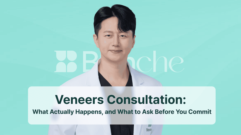 Veneers Consultation: What Actually Happens, and What to Ask Before You Commit