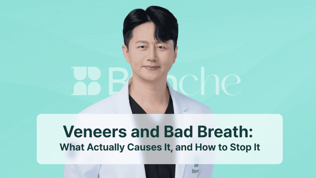 Veneers and Bad Breath: What Actually Causes It, and How to Stop It