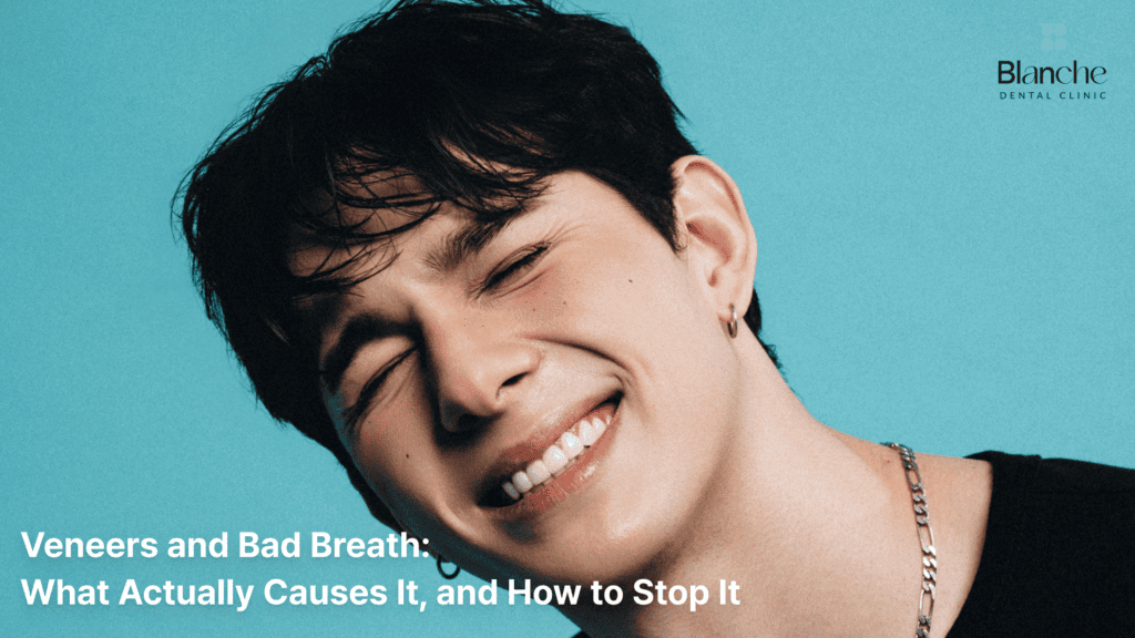 Veneers and Bad Breath: What Actually Causes It, and How to Stop It