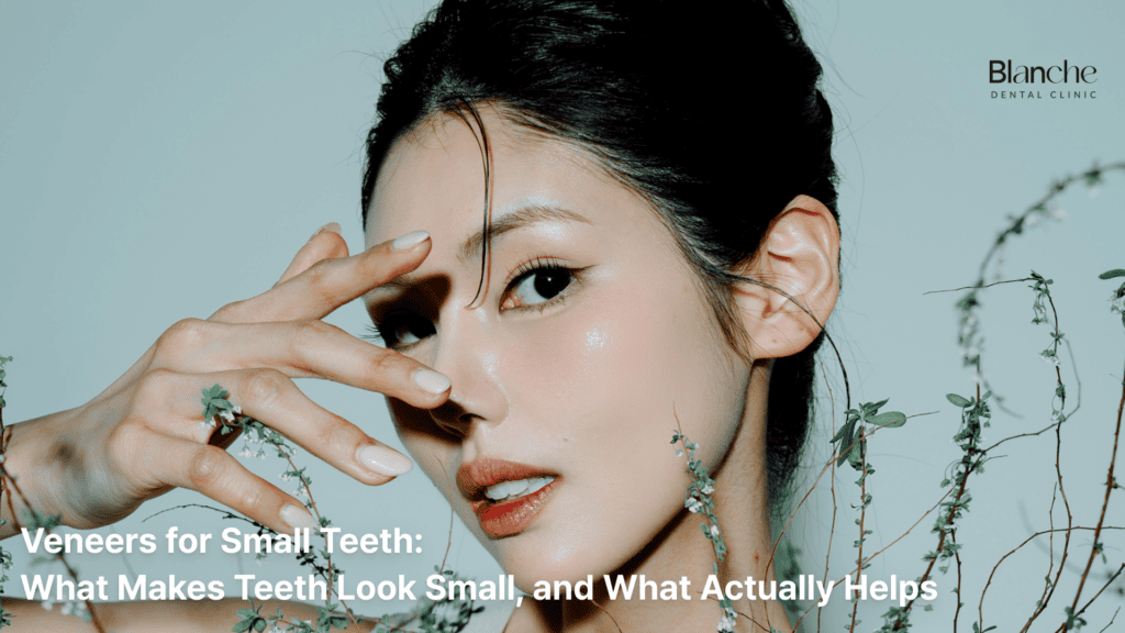 Veneers for Small Teeth: What Makes Teeth Look Small, and What Actually Helps