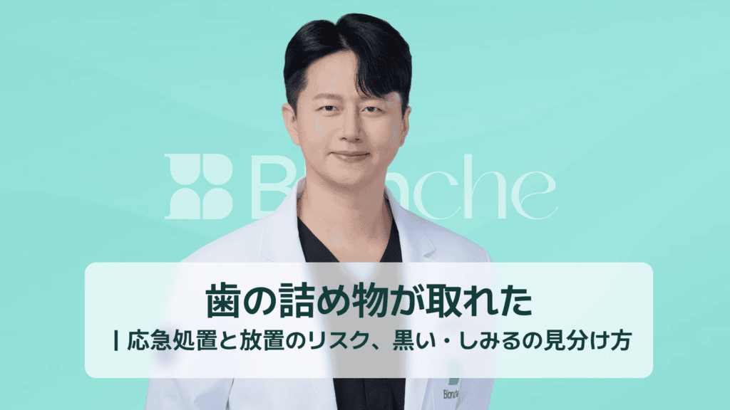 歯の詰め物が取れた｜応急処置と放置のリスク、黒い・しみるの見分け方