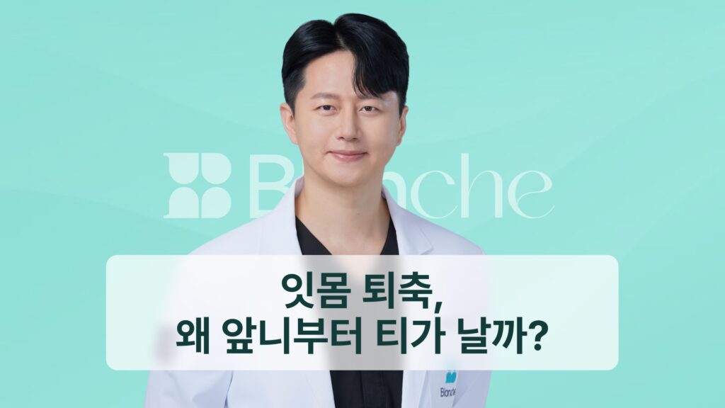 썸네일-잇몸퇴축, 왜 앞니부터 티가 날까?