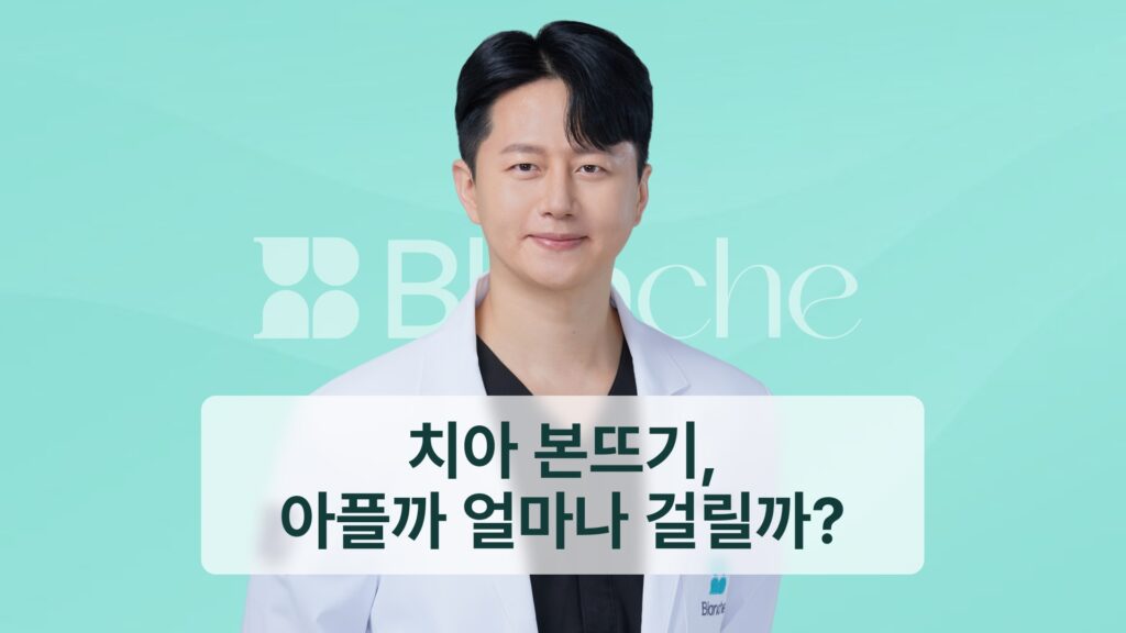 썸네일 - 치아 본뜨기, 아플까 얼마나 걸릴까?