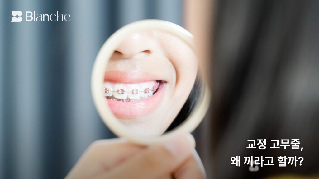 교정 고무줄, 왜 끼라고 할까?