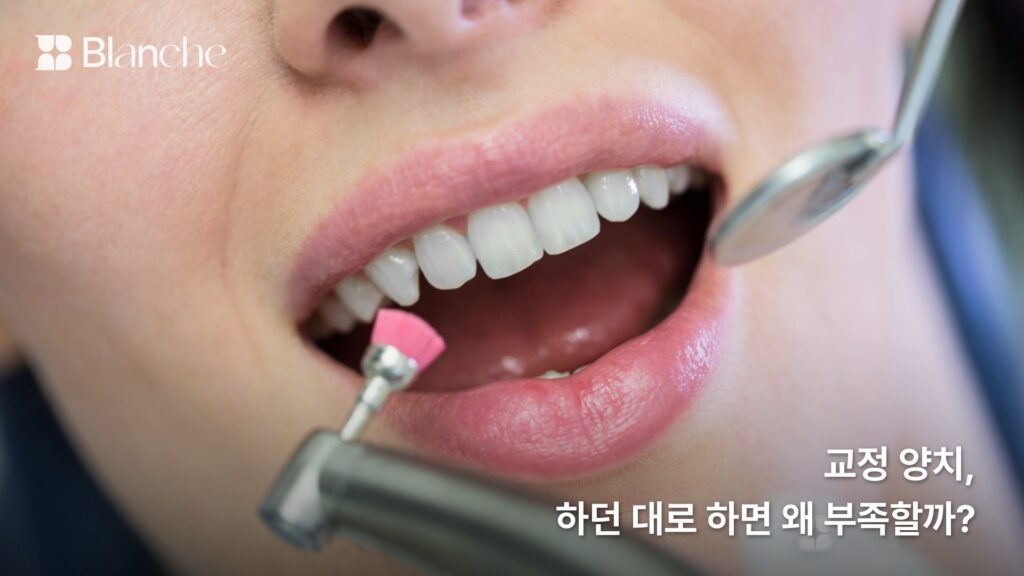교정 양치, 하던 대로 하면 왜 부족할까?