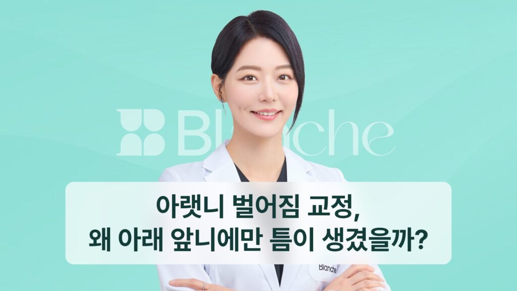 아랫니 벌어짐 교정, 왜 아래 앞니에만 틈이 생겼을까?