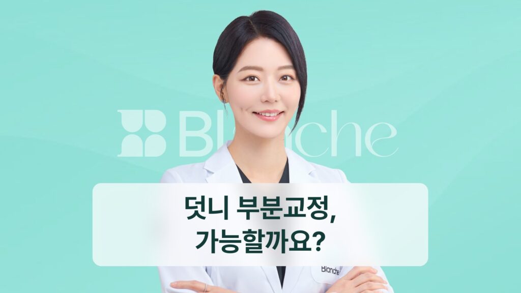 덧니 부분교정, 가능할까요?