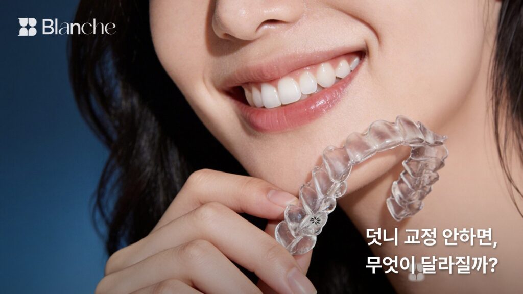 덧니 교정 안하면, 무엇이 달라질까?