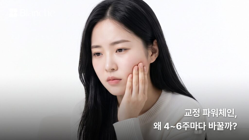 교정 파워체인, 왜 4~6주마다 바꿀까?