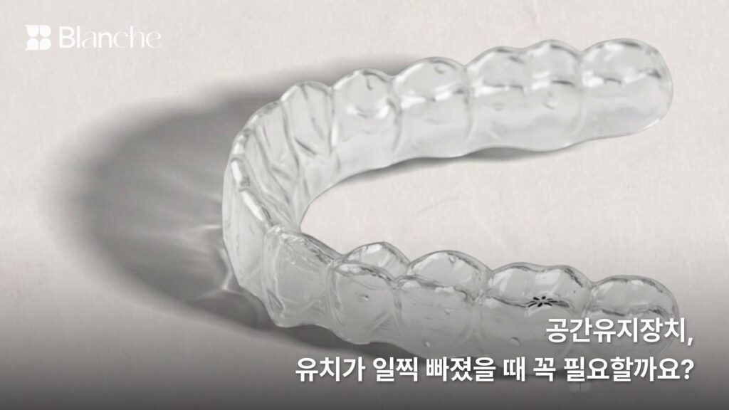 공간유지장치, 유치가 일찍 빠졌을 때 꼭 필요할까요?