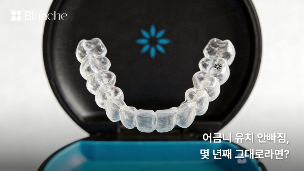 어금니 유치 안빠짐, 몇 년째 그대로라면?