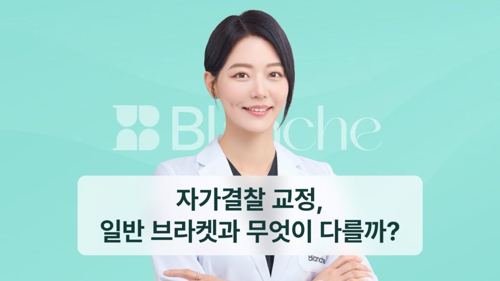 자가결찰 교정, 일반 브라켓과 무엇이 다를까?