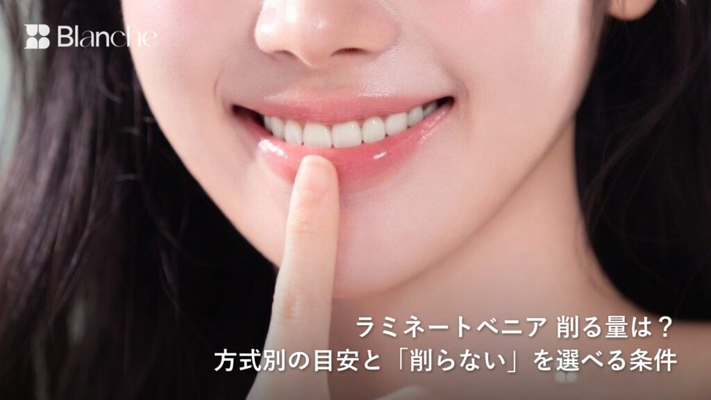 ラミネートベニア 削る量は? 方式別の目安と「削らない」を選べる条件