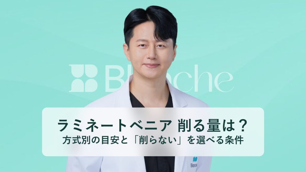 ラミネートベニア 削る量は？ 方式別の目安と「削らない」を選べる条件