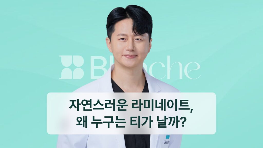 자연스러운 라미네이트, 왜 누구는 티가 날까?