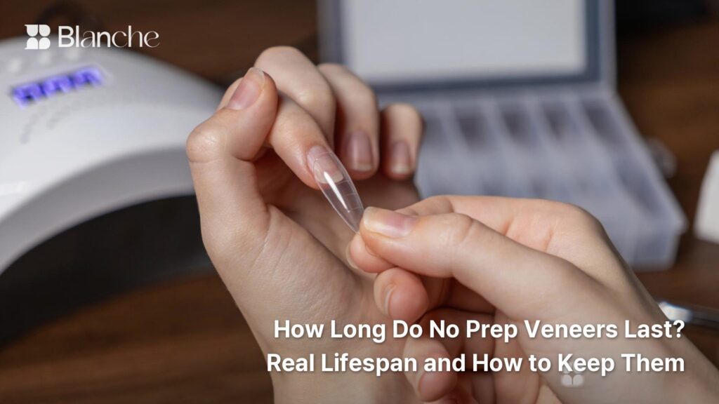 How Long Do No Prep Veneers Last? Real Lifespan and How to Keep Them