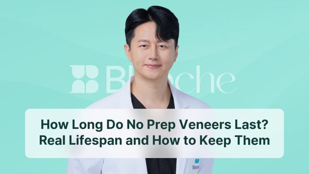 How Long Do No Prep Veneers Last? Real Lifespan and How to Keep Them