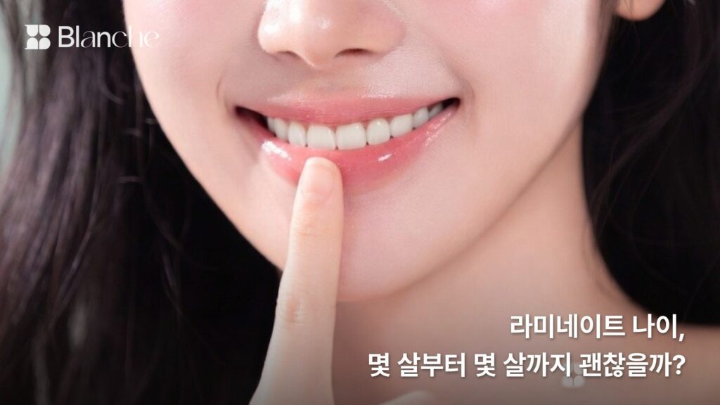 라미네이트 나이, 몇 살부터 몇 살까지 괜찮을까?