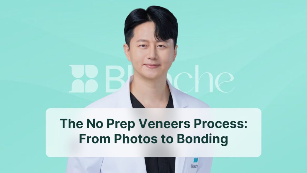 The No Prep Veneers Process: From Photos to Bonding