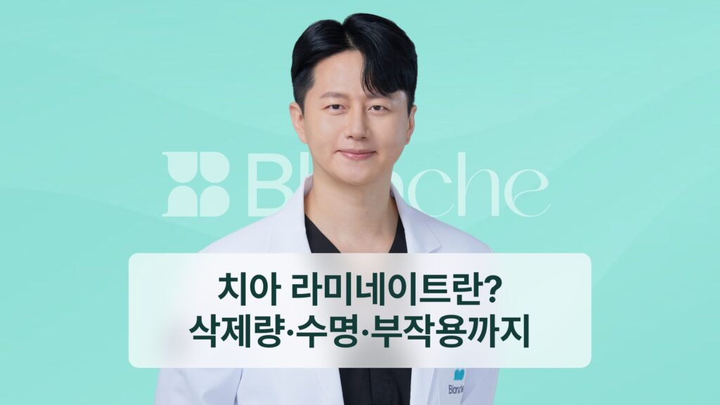 치아 라미네이트란? 삭제량·수명·부작용까지