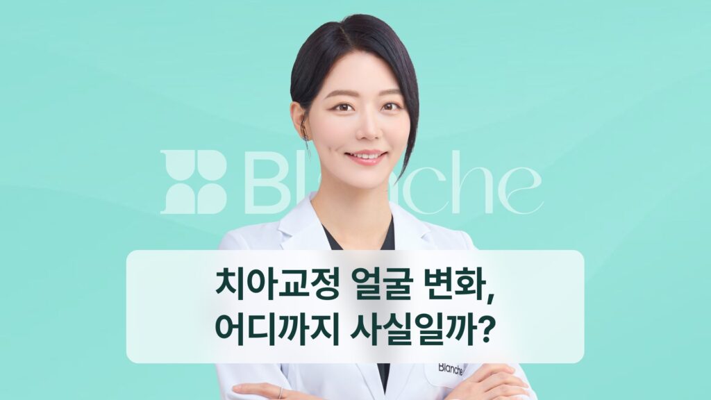 치아교정 얼굴 변화, 어디까지 사실일까?
