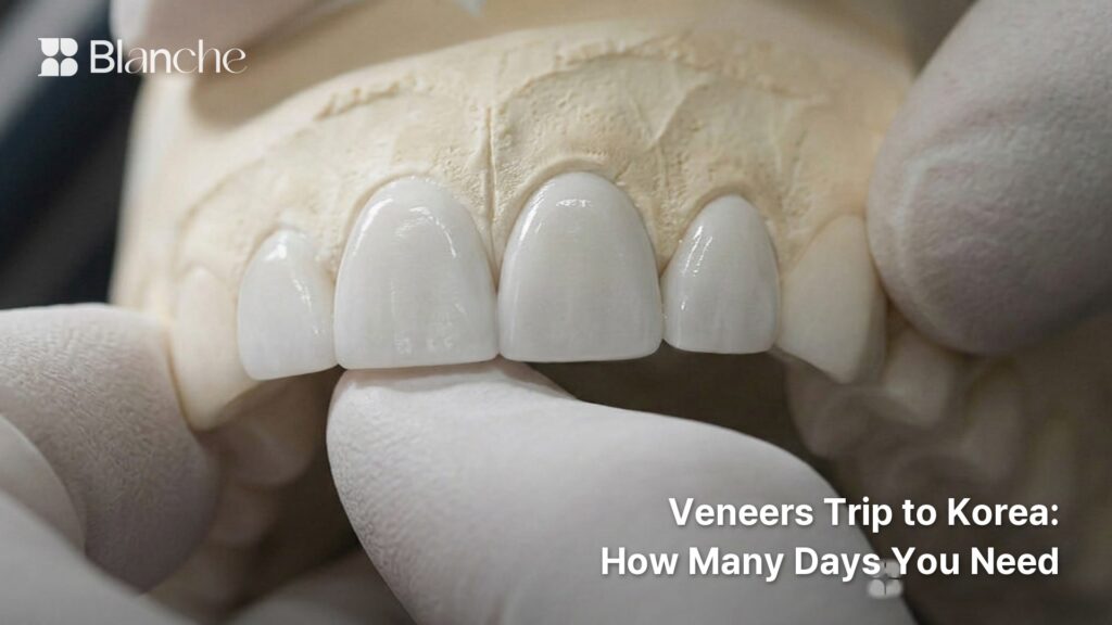Veneers Trip to Korea How Many Days You Need