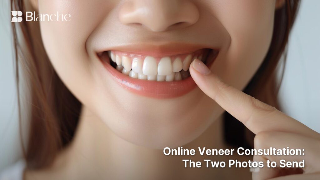Online Veneer Consultation The Two Photos to Send