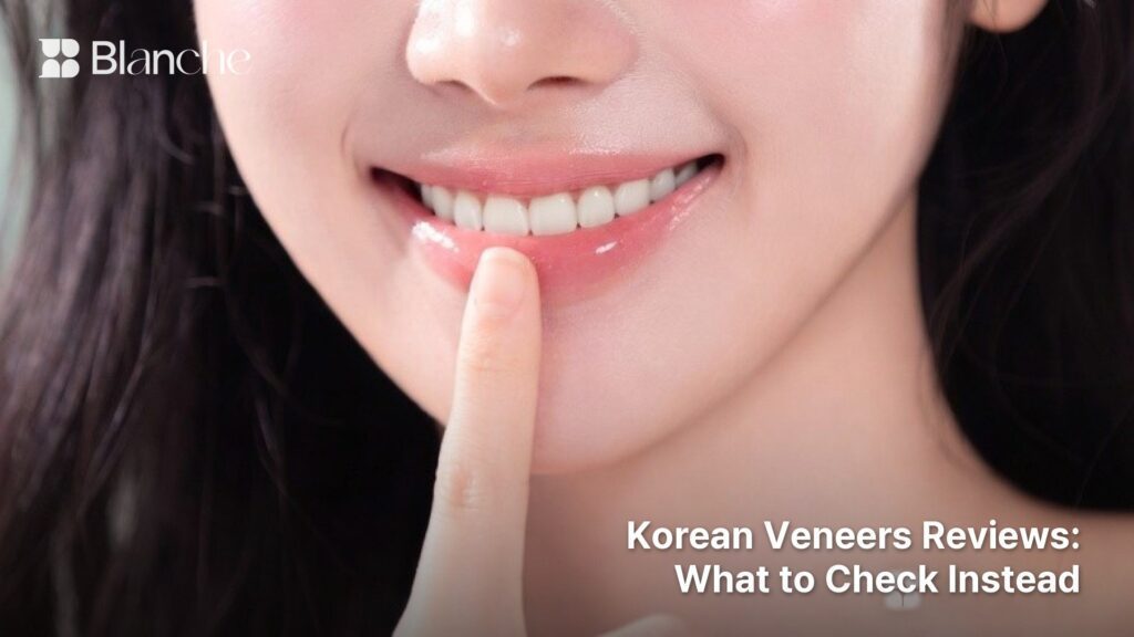 Korean Veneers Reviews What to Check Instead